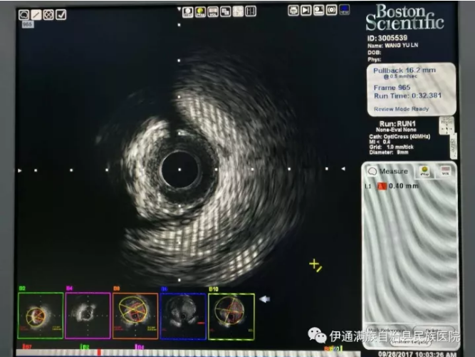 blob.png