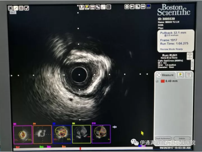 blob.png